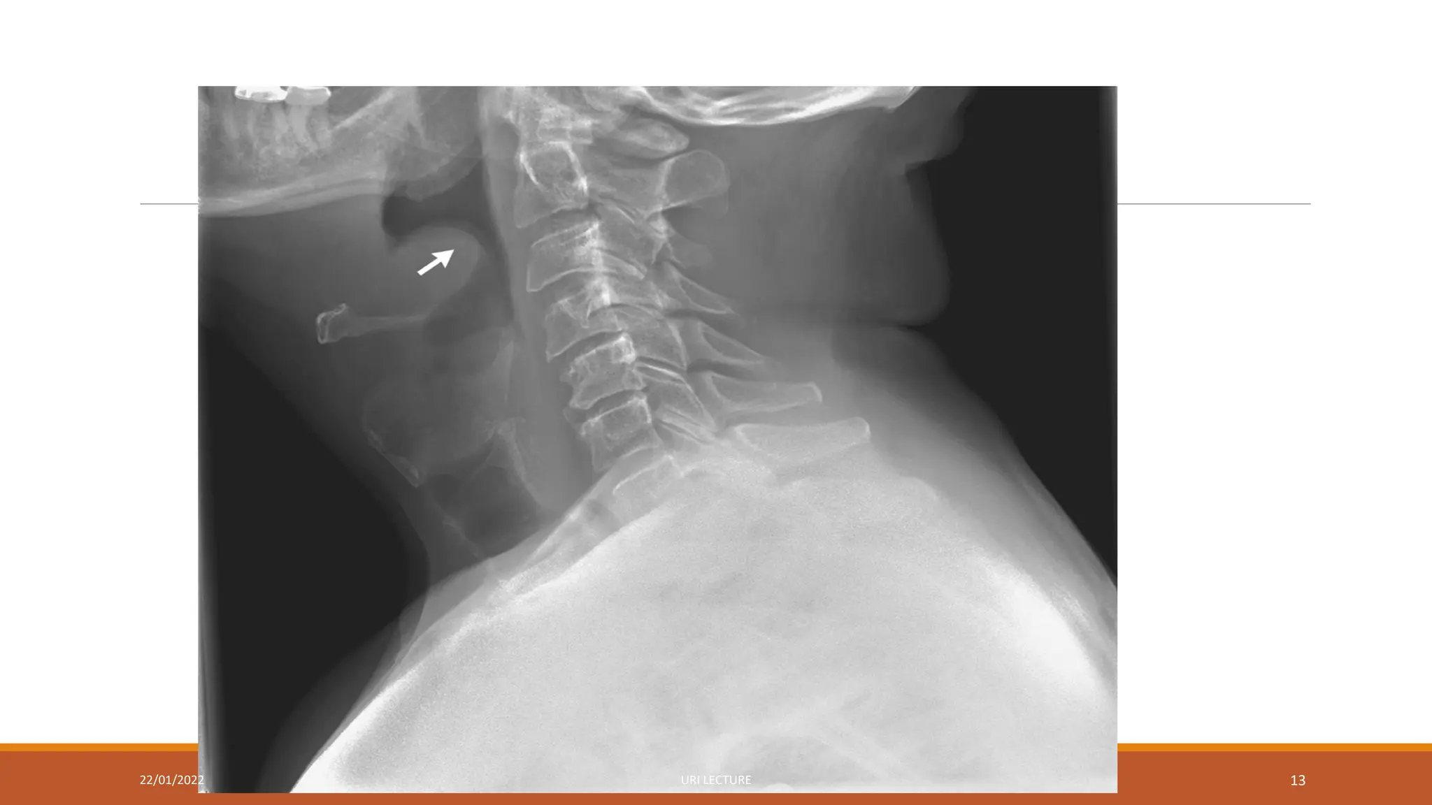 22/01/2022 URI LECTURE 13
 