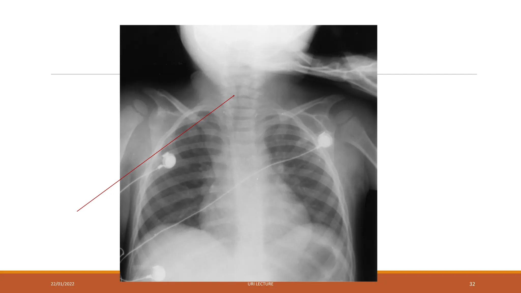 22/01/2022 URI LECTURE 32
 