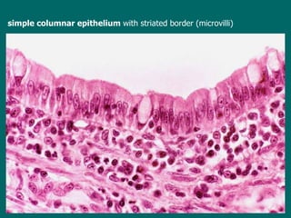 simple columnar epithelium  with striated border (microvilli) 