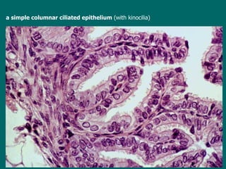 a simple columnar ciliated epithelium  (with kinocilia) 