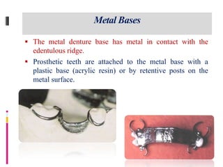 Base Metal Tooth Lecture 7 12 | PPTX