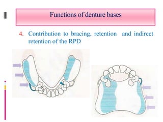 Example Indirect Retention In Rpd Lecture 7 12 | PPTX