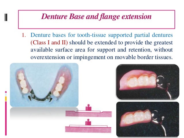 Denture Flange Base  . 3 Фразы В 1 Тематике.