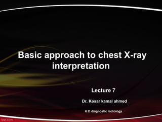 Basic approach to chest X-ray
interpretation
Lecture 7
Dr. Kosar kamal ahmed
H.D diagnostic radiology
 