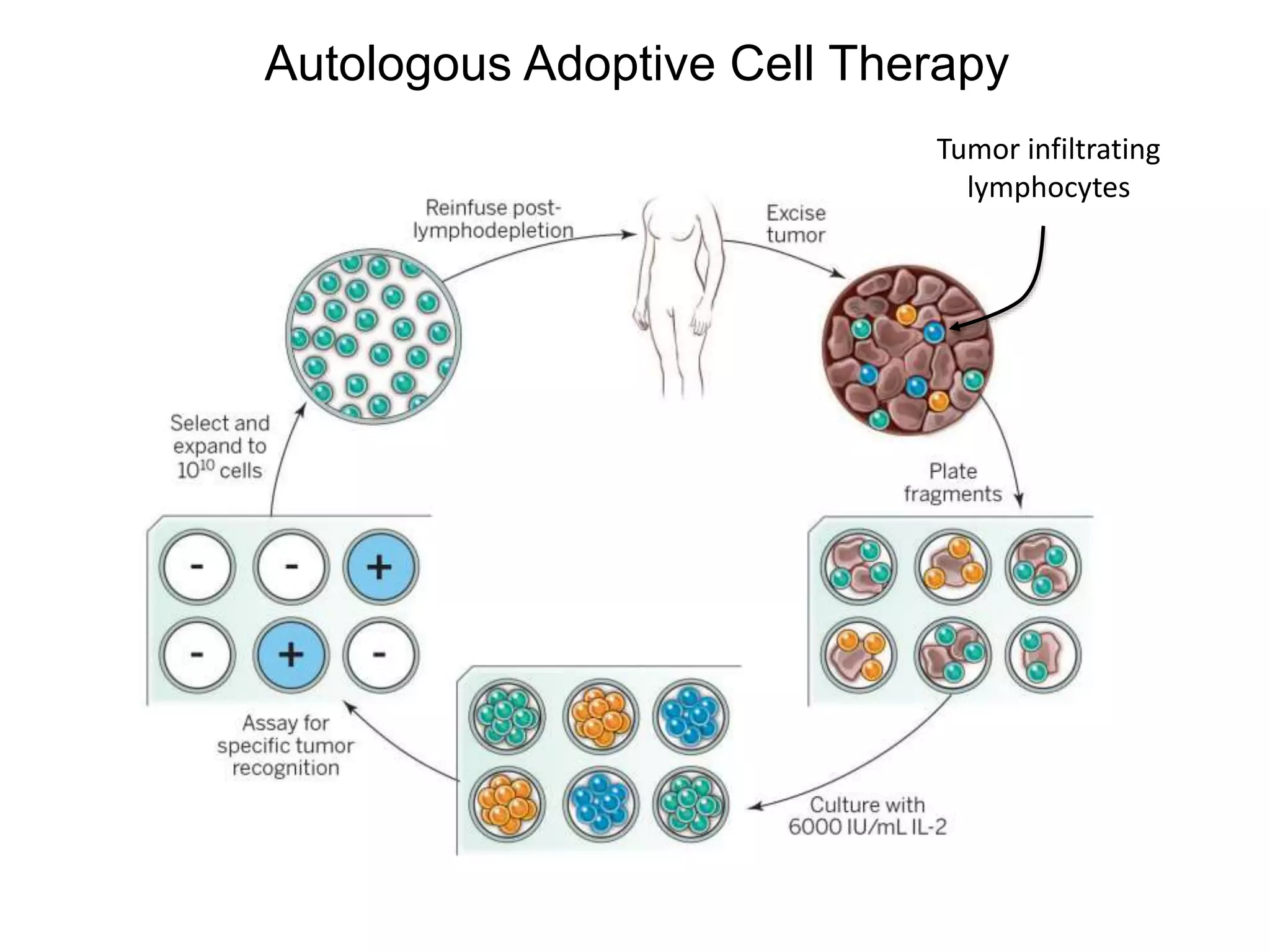 Autologous Adoptive Cell Therapy
Tumor infiltrating
lymphocytes
 