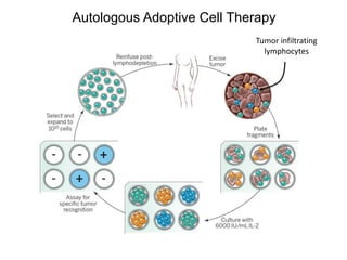 Autologous Adoptive Cell Therapy
Tumor infiltrating
lymphocytes
 