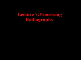 Lecture 7:Processing
Radiographs
 