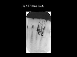 Fig. 7, Developer splash.
 