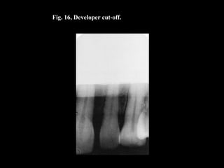 Fig. 16, Developer cut-off.
 