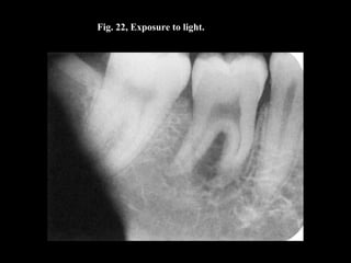 Fig. 22, Exposure to light.
 