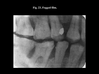 Fig. 23, Fogged film.
 