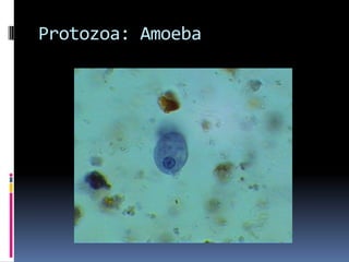Protozoa