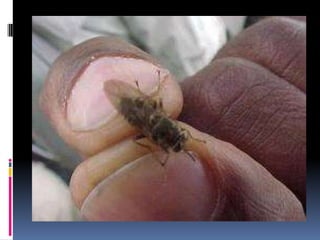 Example: TrypanosomiasisAfrican trypanosomiasis (Sleeping sickness)Tsetse fly (Glossinia) is the vectorThe trypanosomes migrate through the blood to lymph nodes This triggers ongoing attacks of fever The attacks can be intermittent and recur over a period of weeks to months These sustained attacks can often result in heart damage  As the disease progresses trypanosomes invade the central nervous system, causing meningoencephalitis