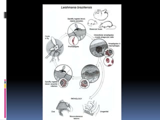 Cutaneousleishmaniasis