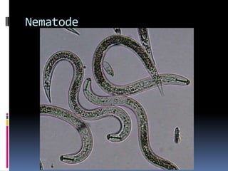 Parasites: HelminthsAschelminths (roundworms)Nematodes (e.g. Toxocara, pinworms)