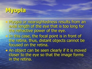Myopia <ul><li>Myopia or nearsightedness results from an axial length of the eye that is too long for the refractive power...