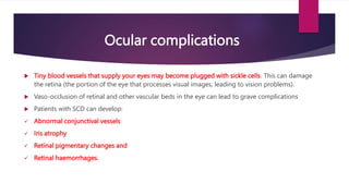 Lecture 7 (SCD New) 2.pptx | Blood Disorders | Diseases and Conditions