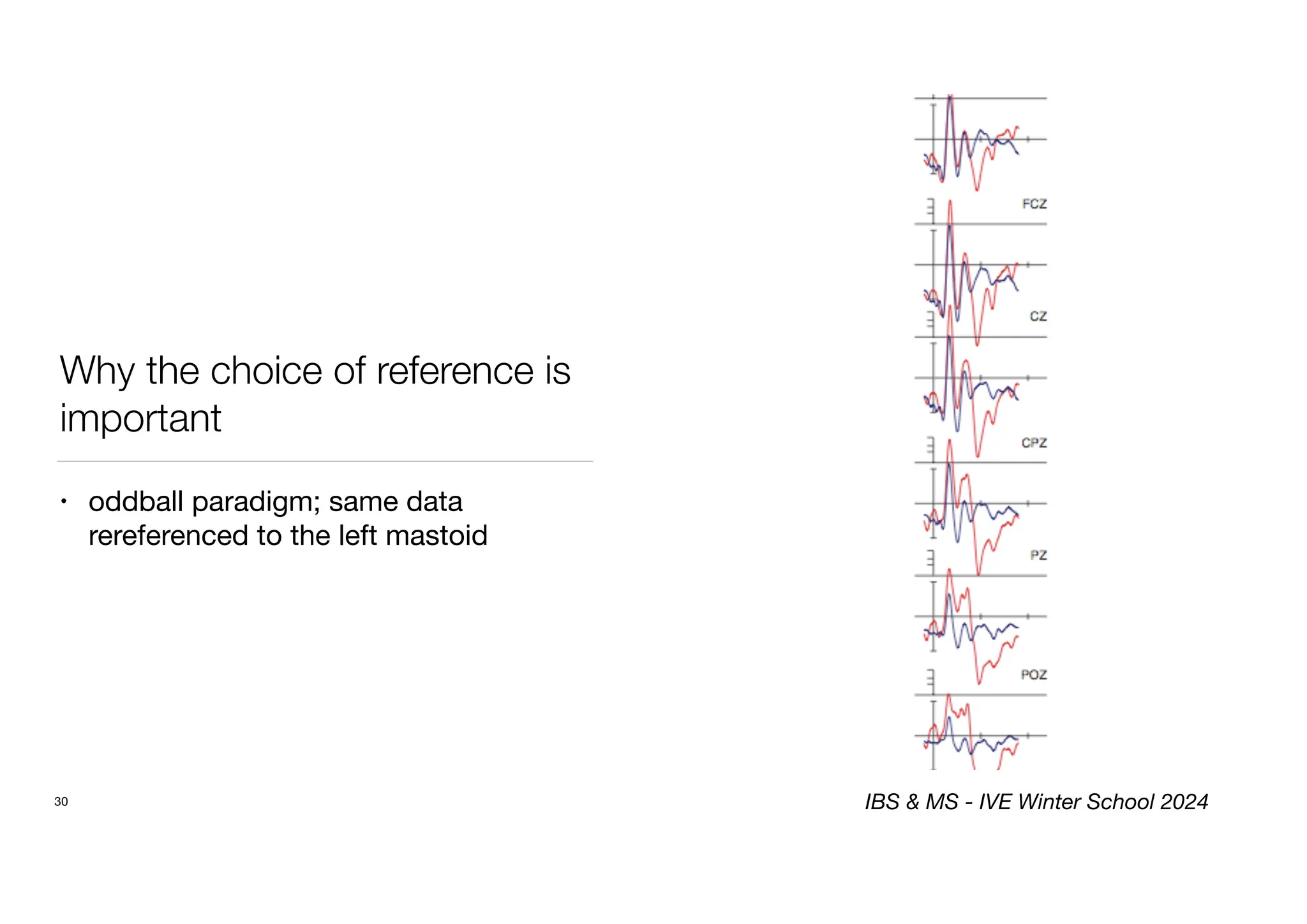 Why the choice of reference is
important
• oddball paradigm; same data
rereferenced to the left mastoid
30 IBS & MS - IVE Winter School 2024
 