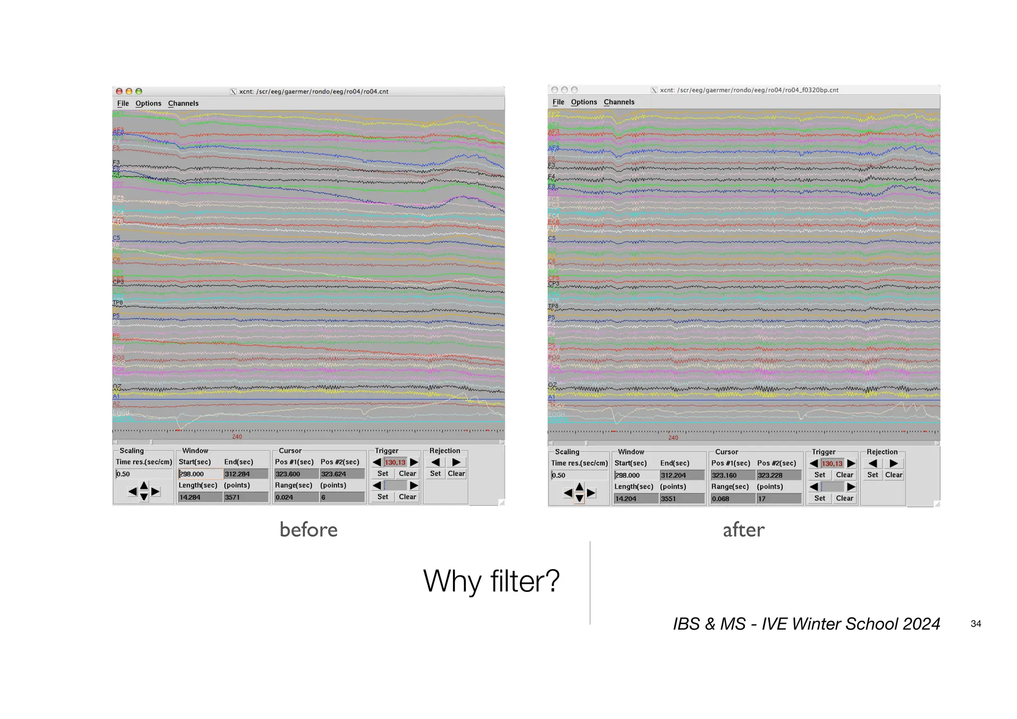 Why filter?
34
before after
IBS & MS - IVE Winter School 2024
 