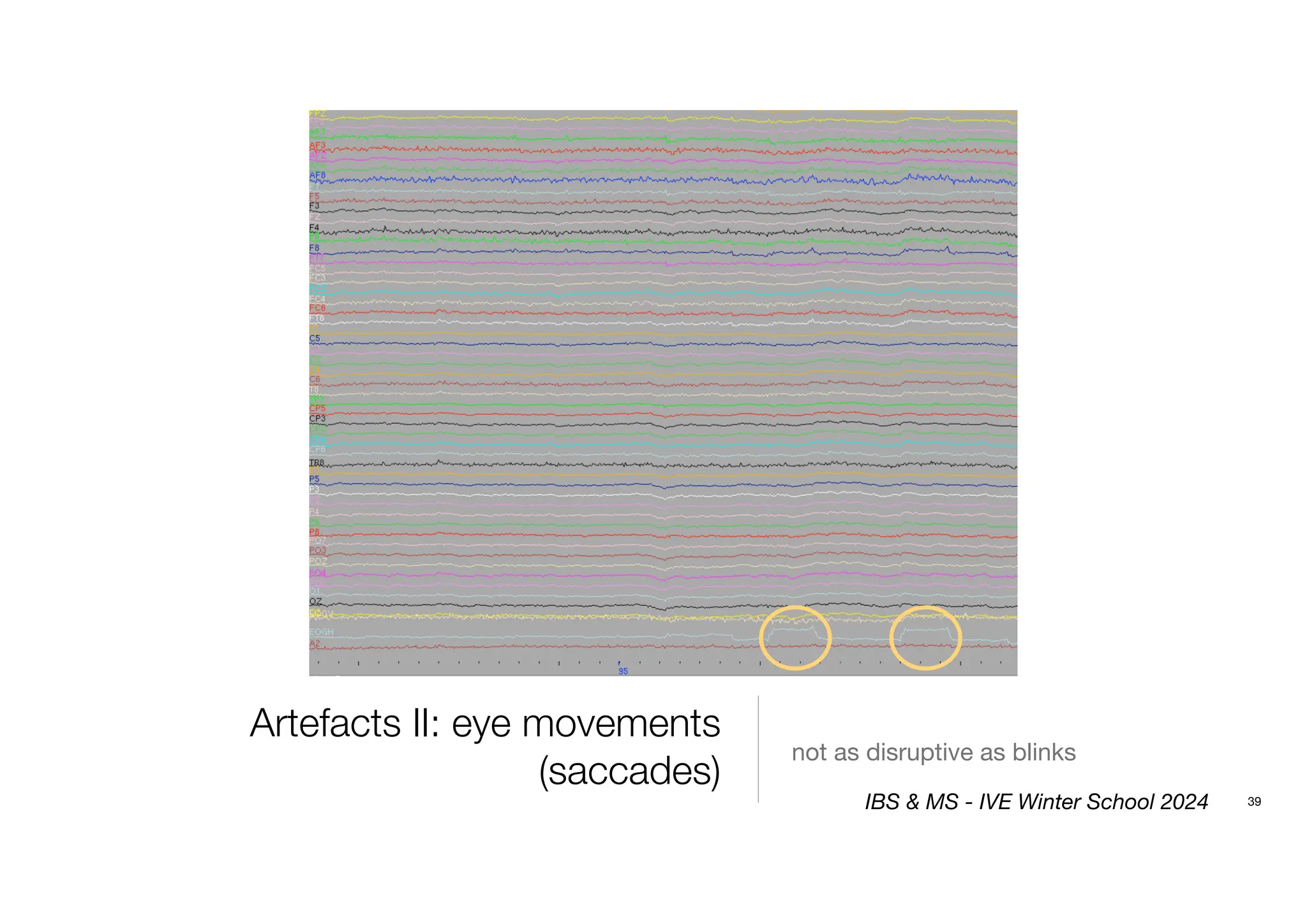 Artefacts II: eye movements
(saccades)
not as disruptive as blinks
39
IBS & MS - IVE Winter School 2024
 
