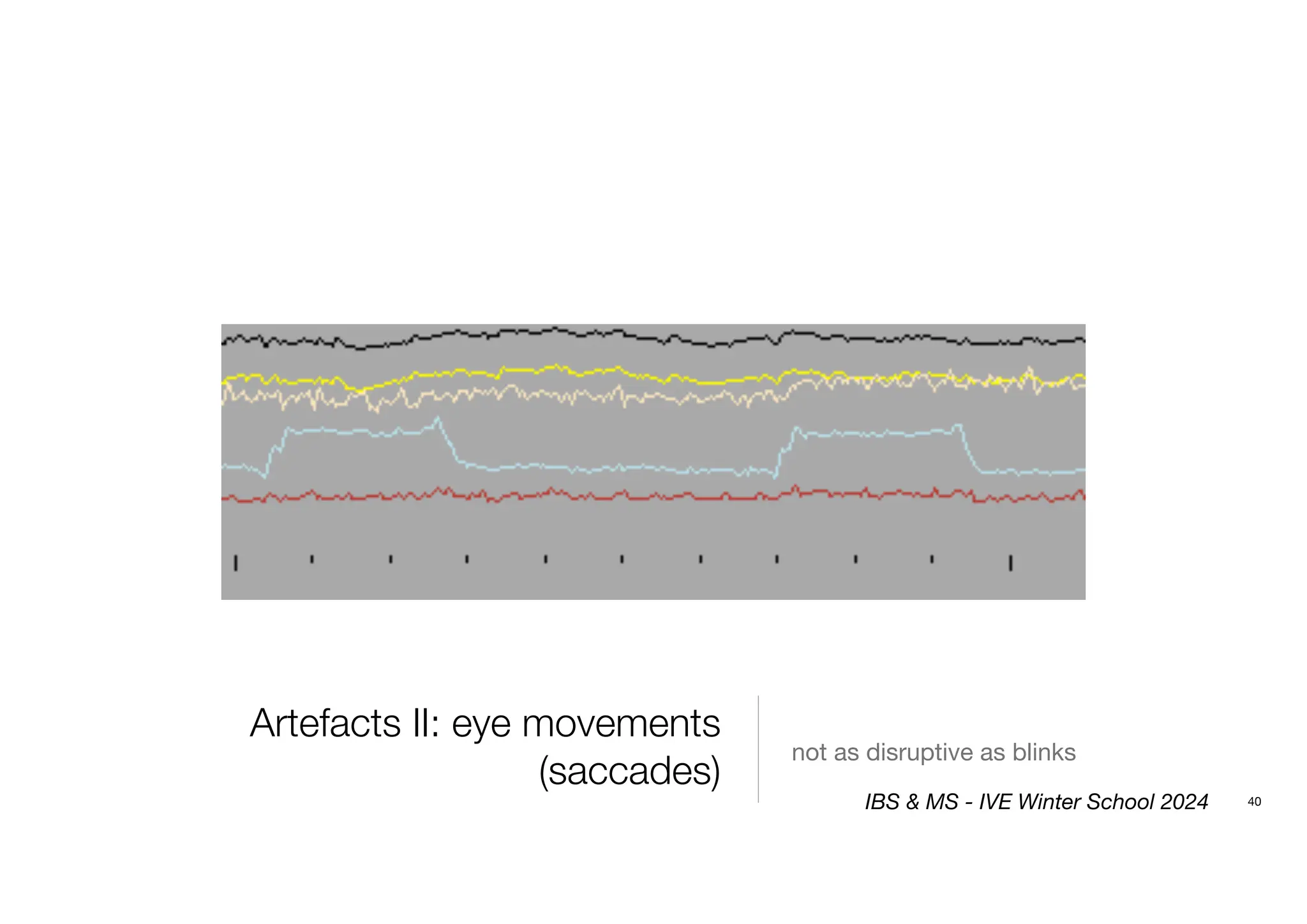 Artefacts II: eye movements
(saccades)
not as disruptive as blinks
40
IBS & MS - IVE Winter School 2024
 