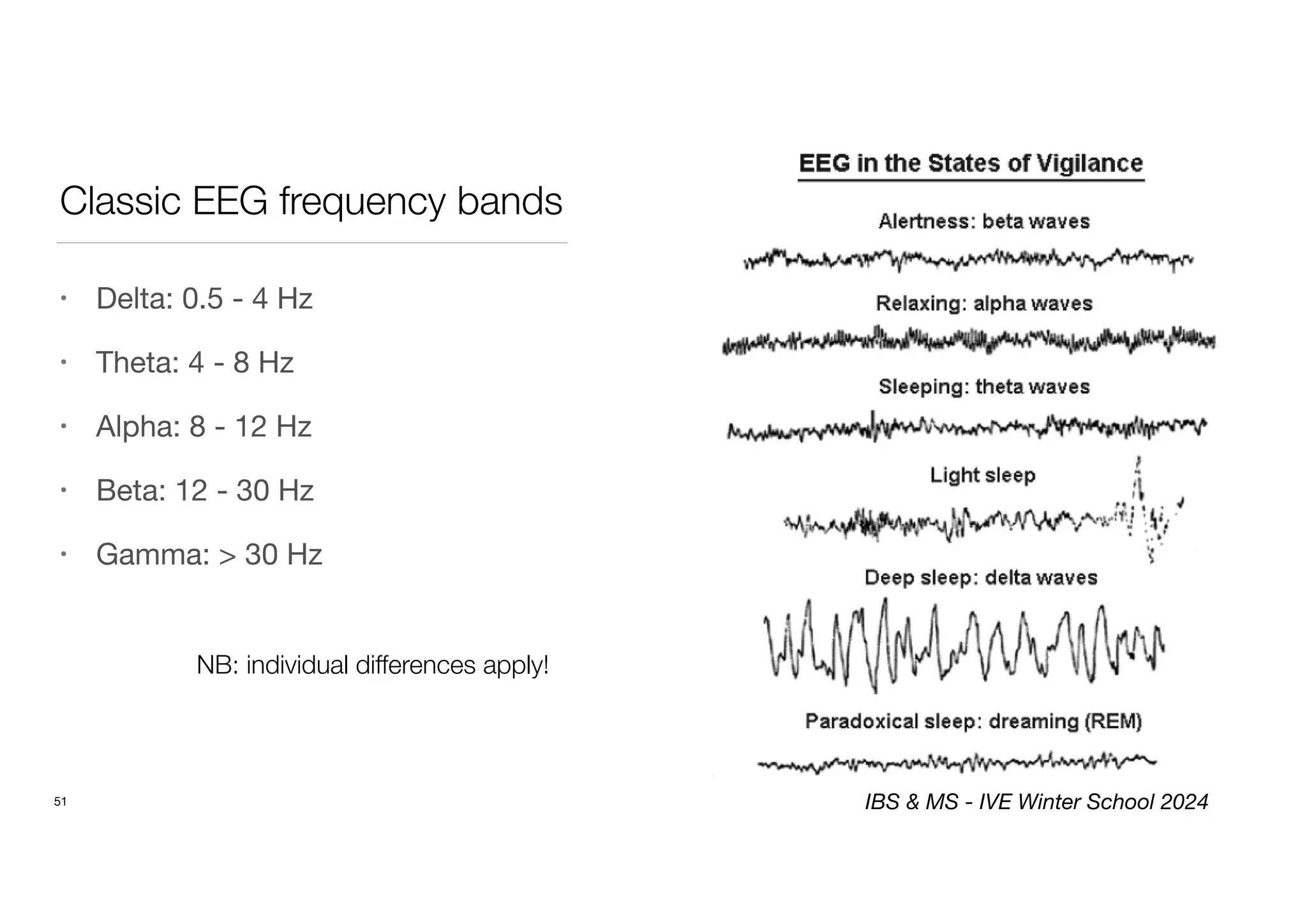 Classic EEG frequency bands
• Delta: 0.5 - 4 Hz
• Theta: 4 - 8 Hz
• Alpha: 8 - 12 Hz
• Beta: 12 - 30 Hz
• Gamma: > 30 Hz
51
NB: individual differences apply!
IBS & MS - IVE Winter School 2024
 