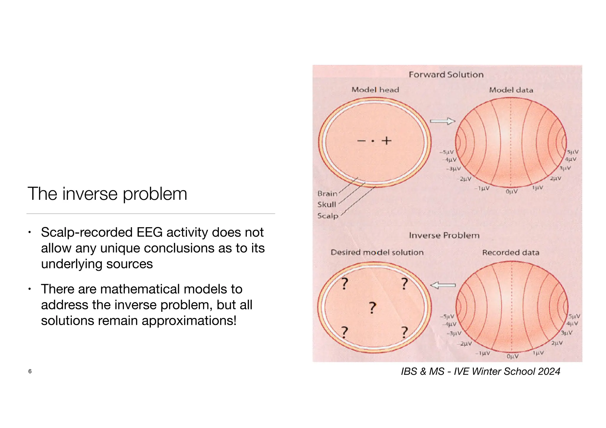 The inverse problem
• Scalp-recorded EEG activity does not
allow any unique conclusions as to its
underlying sources
• There are mathematical models to
address the inverse problem, but all
solutions remain approximations!
6 IBS & MS - IVE Winter School 2024
 