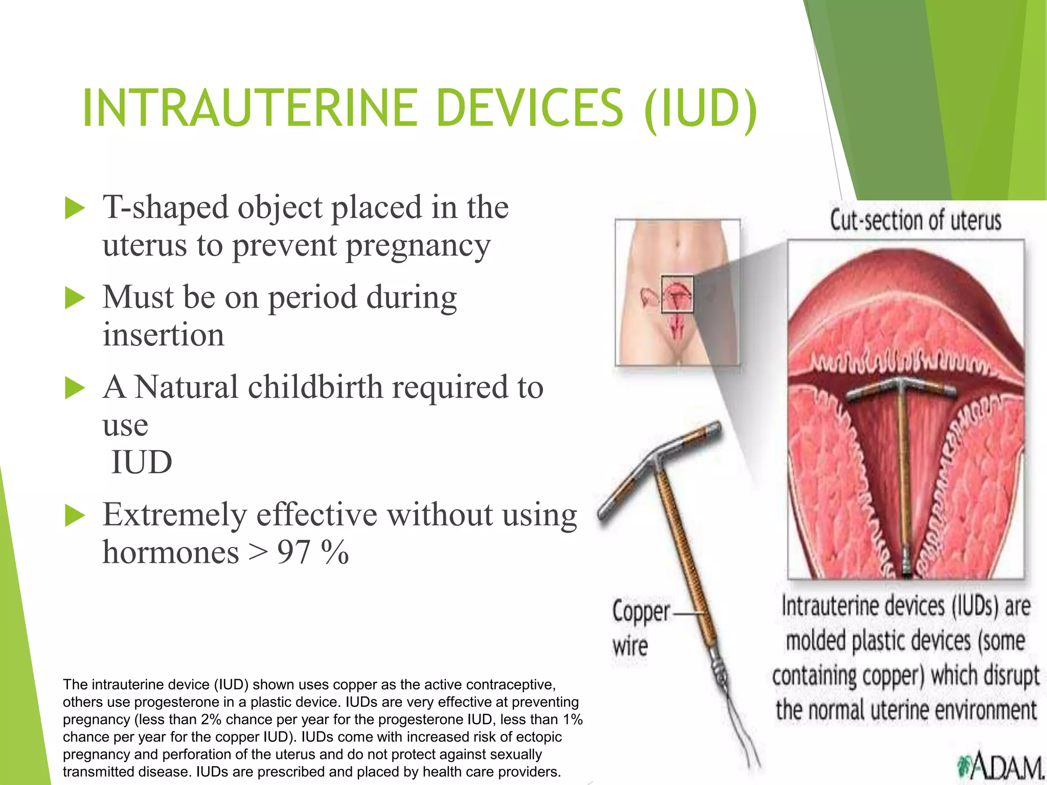 INTRAUTERINE DEVICES (IUD)
 T-shaped object placed in the
uterus to prevent pregnancy
 Must be on period during
insertion
 A Natural childbirth required to
use
IUD
 Extremely effective without using
hormones > 97 %
The intrauterine device (IUD) shown uses copper as the active contraceptive,
others use progesterone in a plastic device. IUDs are very effective at preventing
pregnancy (less than 2% chance per year for the progesterone IUD, less than 1%
chance per year for the copper IUD). IUDs come with increased risk of ectopic
pregnancy and perforation of the uterus and do not protect against sexually
transmitted disease. IUDs are prescribed and placed by health care providers.
 