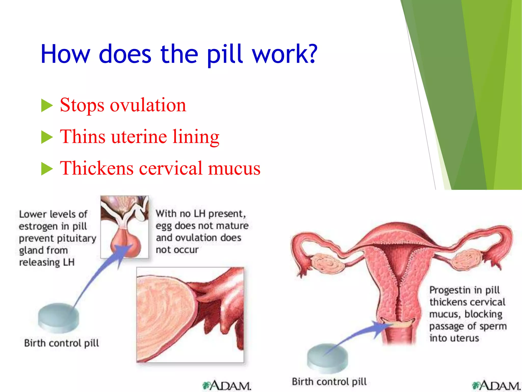 How does the pill work?
 Stops ovulation
 Thins uterine lining
 Thickens cervical mucus
 