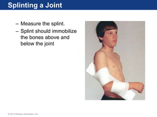 Splint Verbindung Lecture 8_M11_KARR120_10E_PPT_C11study.ppt