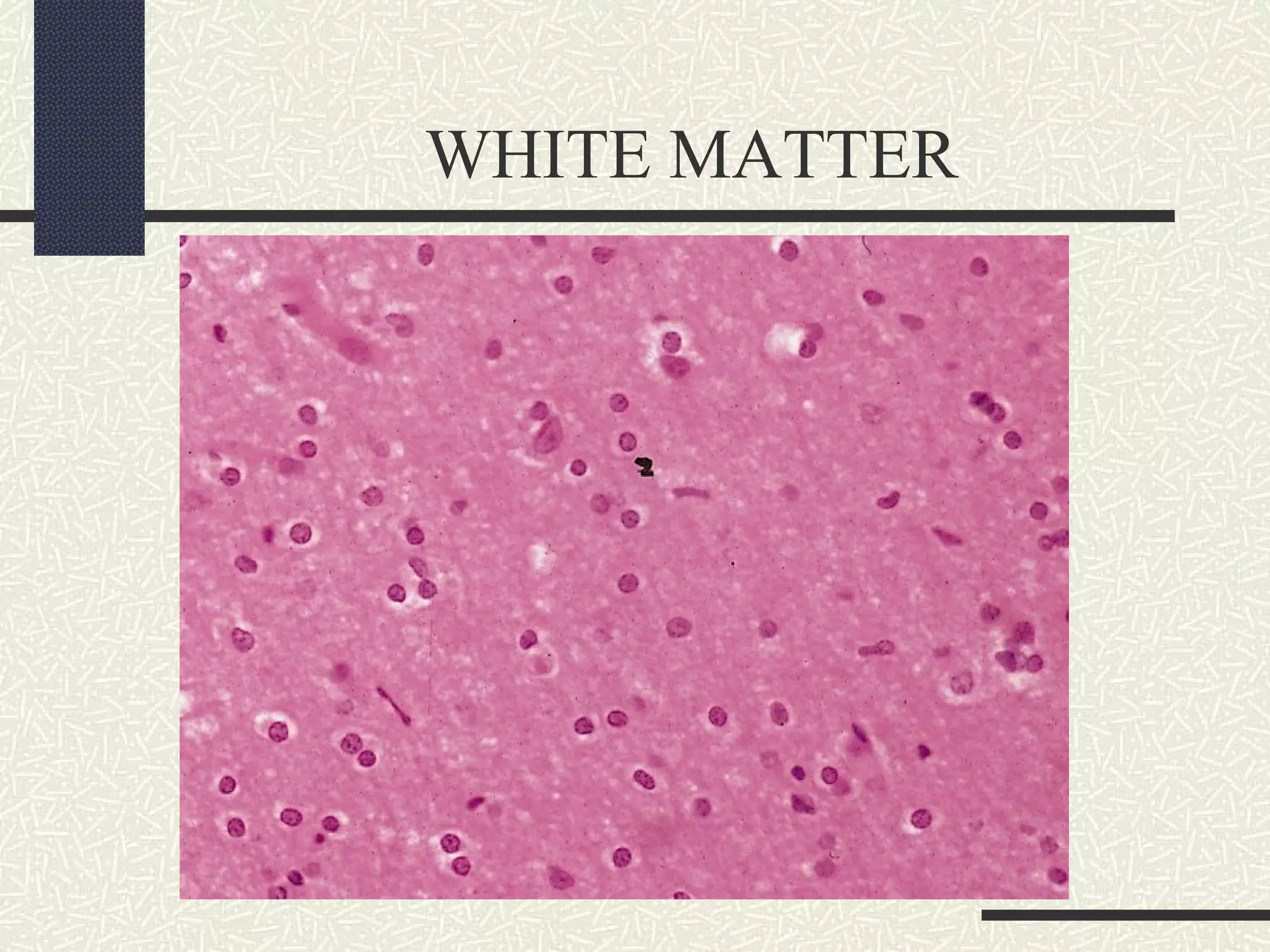 WHITE MATTER

 
