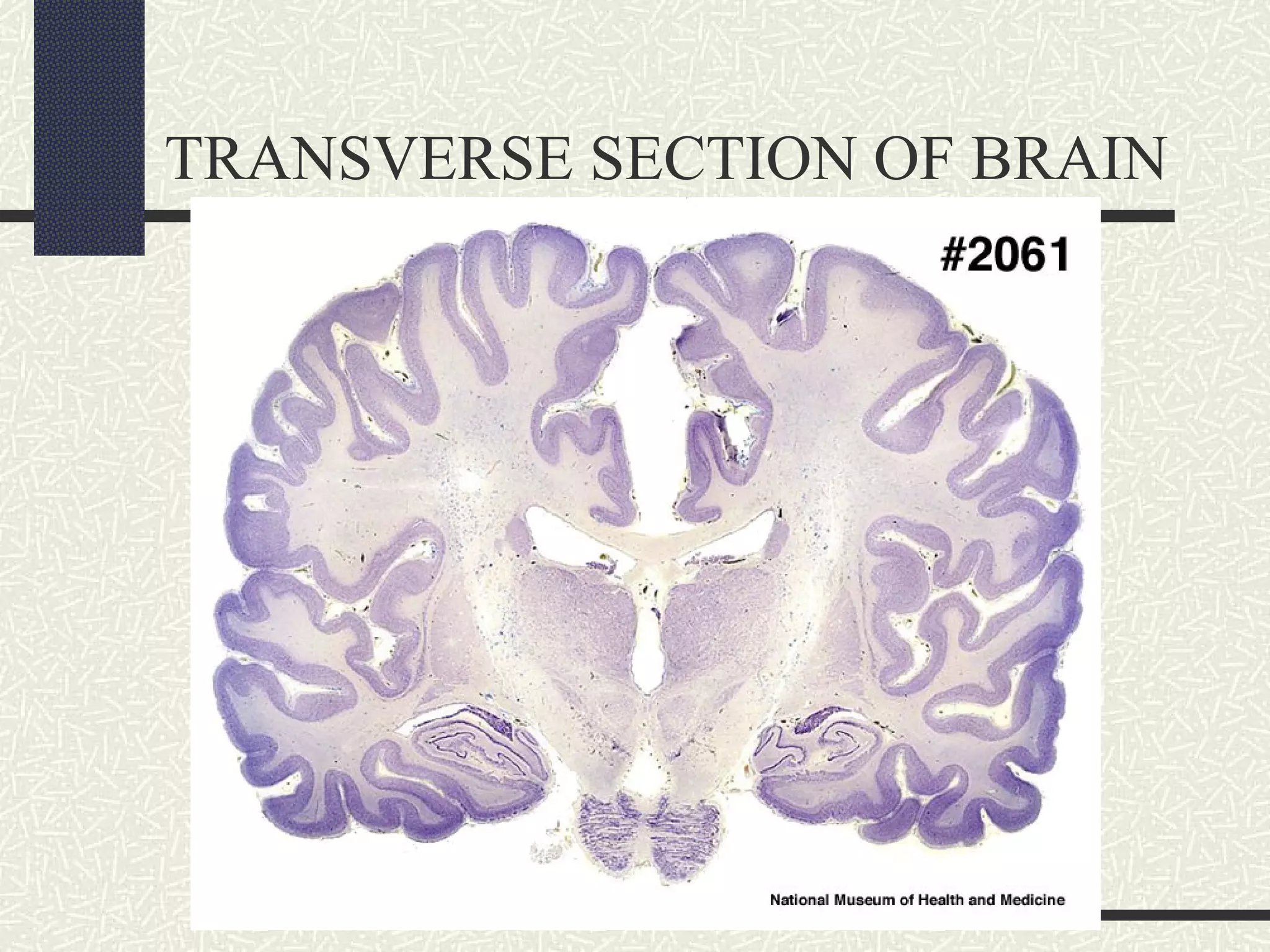 TRANSVERSE SECTION OF BRAIN

 