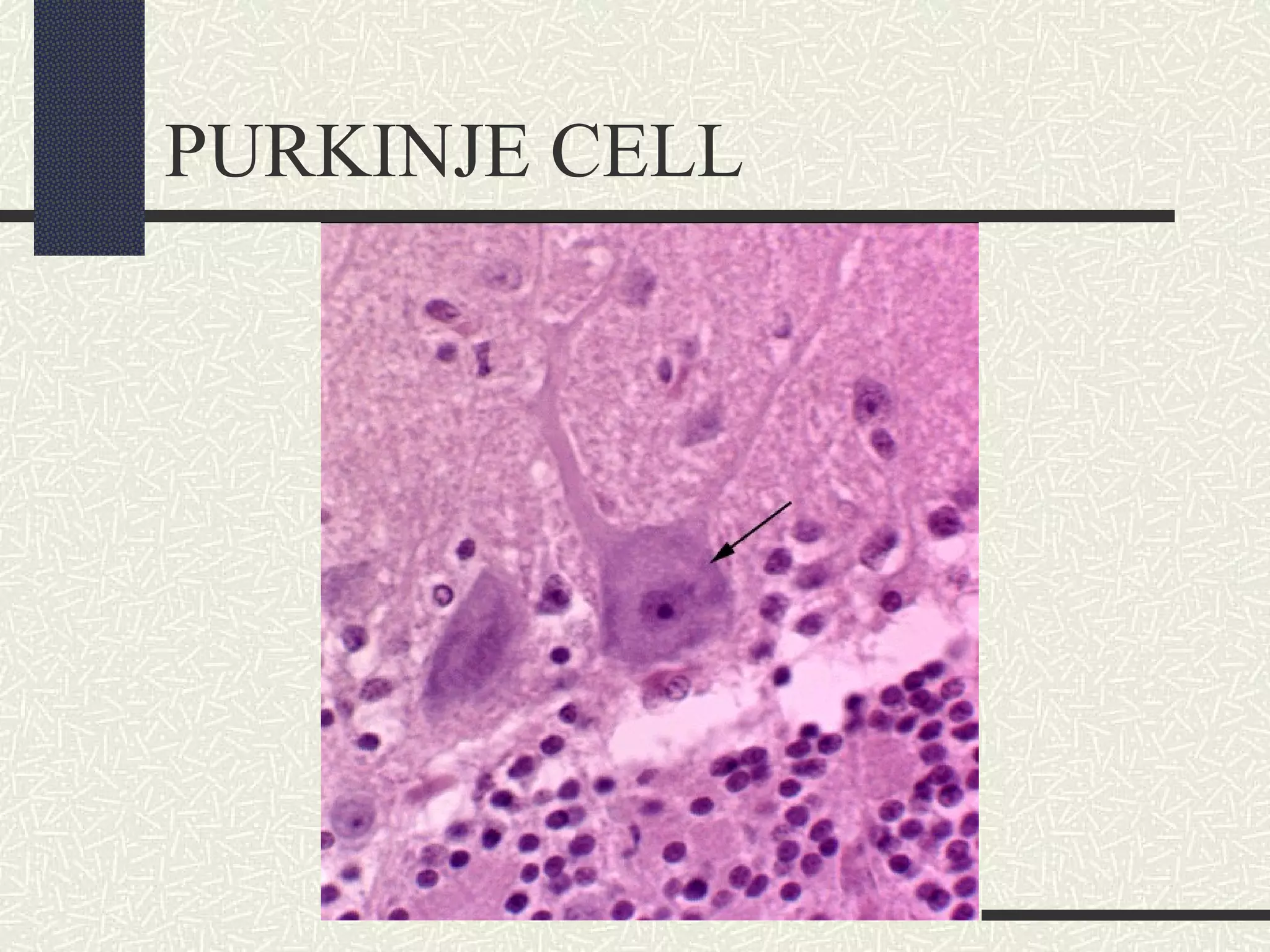 PURKINJE CELL

 