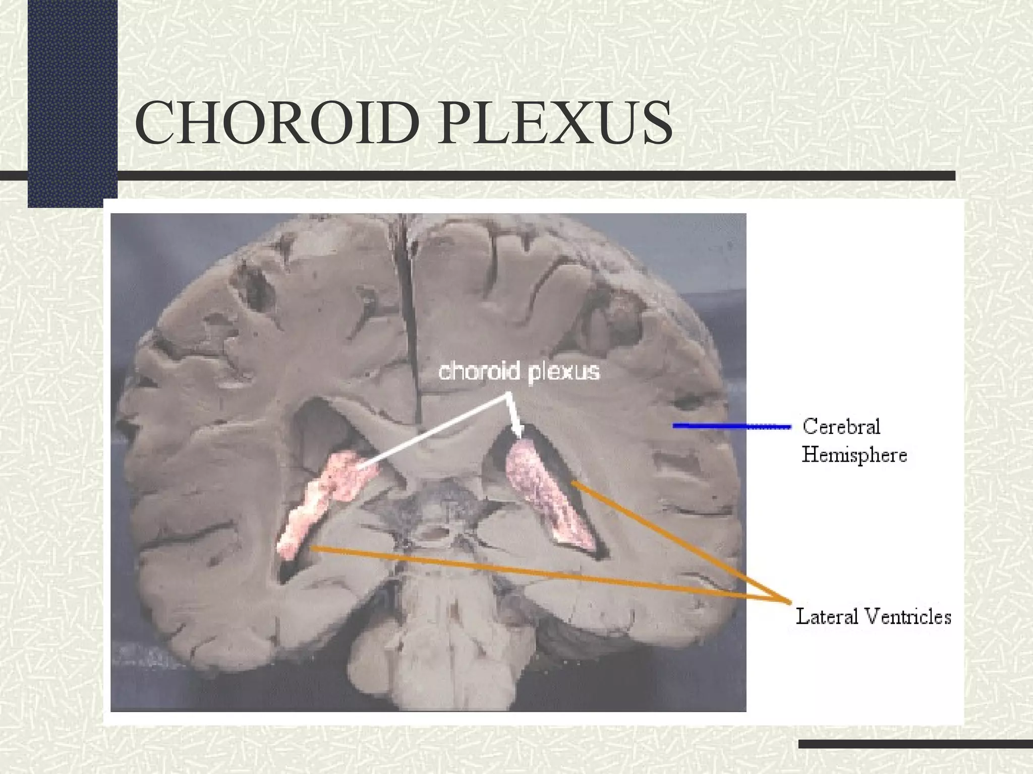 CHOROID PLEXUS

 