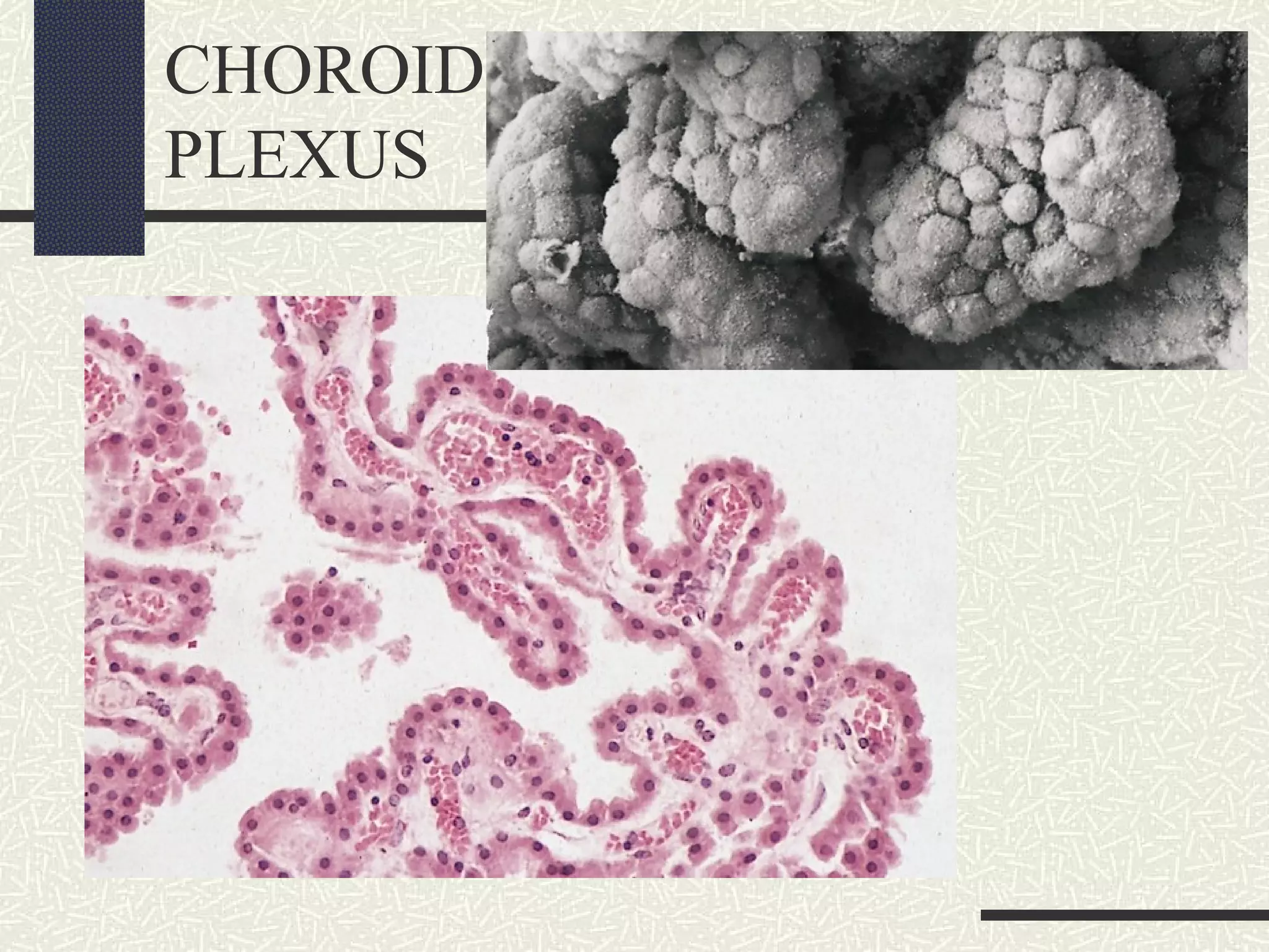 CHOROID
PLEXUS

 