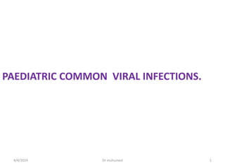4/4/2024 Dr muhumed 1
PAEDIATRIC COMMON VIRAL INFECTIONS.
 