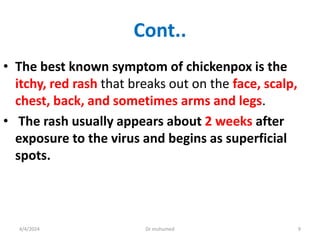Lecture 9 Paediatric viral infections 1.-1.pptx