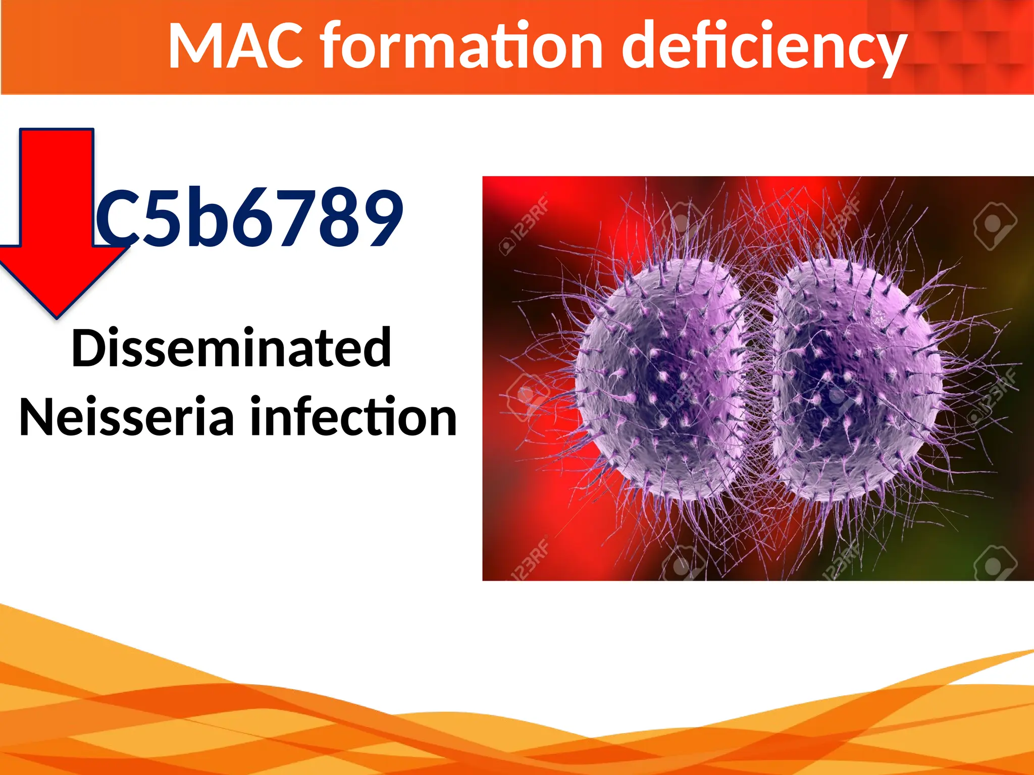 MAC formation deficiency
Disseminated
Neisseria infection
C5b6789
 