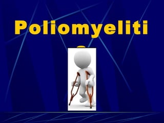 Poliomyeliti
s
 