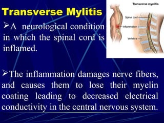 Transverse Mylitis
A neurological condition
in which the spinal cord is
inflamed.
The inflammation damages nerve fibers,
and causes them to lose their myelin
coating leading to decreased electrical
conductivity in the central nervous system.
 