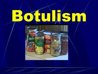 Botulism
 