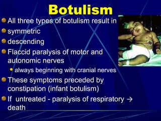 All three types of botulism result in
symmetric
descending
Flaccid paralysis of motor and
autonomic nerves
always beginning with cranial nerves
These symptoms preceded by
constipation (infant botulism)
If untreated - paralysis of respiratory →
death
Botulism
 