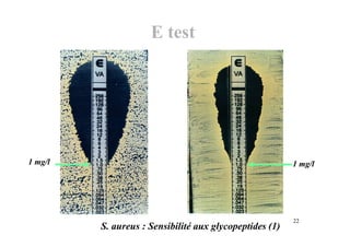 S. aureus : Sensibilité aux glycopeptides (1)
1 mg/l 1 mg/l
E test
22
 