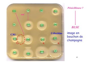 Pénicillinase ?
oui
AMX TIC PIP Mec
CTX AMC
TZP MA
TCC
CF
CAZ
FOX
IP
MOX
FEP
AZT
BLSE
image en
bouchon de
champagne
43
Céfoxitine
C3G
 