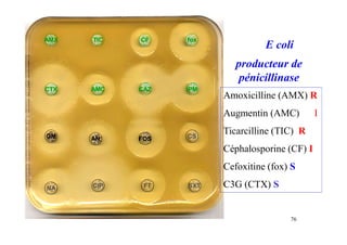 E coli
AMX TIC CF fox
CTX AMC CAZ IPM
GM AN FOS CS
NA CIP FT SXT
producteur de
pénicillinase
76
Amoxicilline (AMX) R
Augmentin (AMC) I
Ticarcilline (TIC) R
Céphalosporine (CF) I
Cefoxitine (fox) S
C3G (CTX) S
 