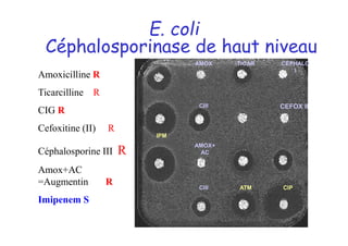 Céphalosporinase de haut niveau
CEPHALO
I
AMOX
AMOX+
AC
IPM
CIII ATM CIP
CIII
TICAR
CEFOX II
Amoxicilline R
Ticarcilline R
CIG R
Cefoxitine (II) R
Céphalosporine III R
Amox+AC
=Augmentin R
Imipenem S
E. coli
79
 