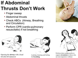 If Abdominal
Thrusts Don’t Work
• Finger sweep
• Abdominal thrusts
• Check ABCs (Airway, Breathing
and Circulation)
• Perform CPR (cardio-pulmonary
resuscitatio) if not breathing
Opening the airway with a head
tilt-chin lift maneuver
Looking, listening and feeling
for breathing
Perform chest compressions to
support circulation in those who
are non-responsive without
 