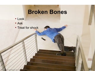 Broken Bones
• Look
• Ask
• Treat for shock
© Business & Legal Reports, Inc. 1110
 