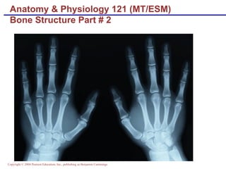 Anatomy & Physiology 121 (MT/ESM) Bone Structure Part # 2 
