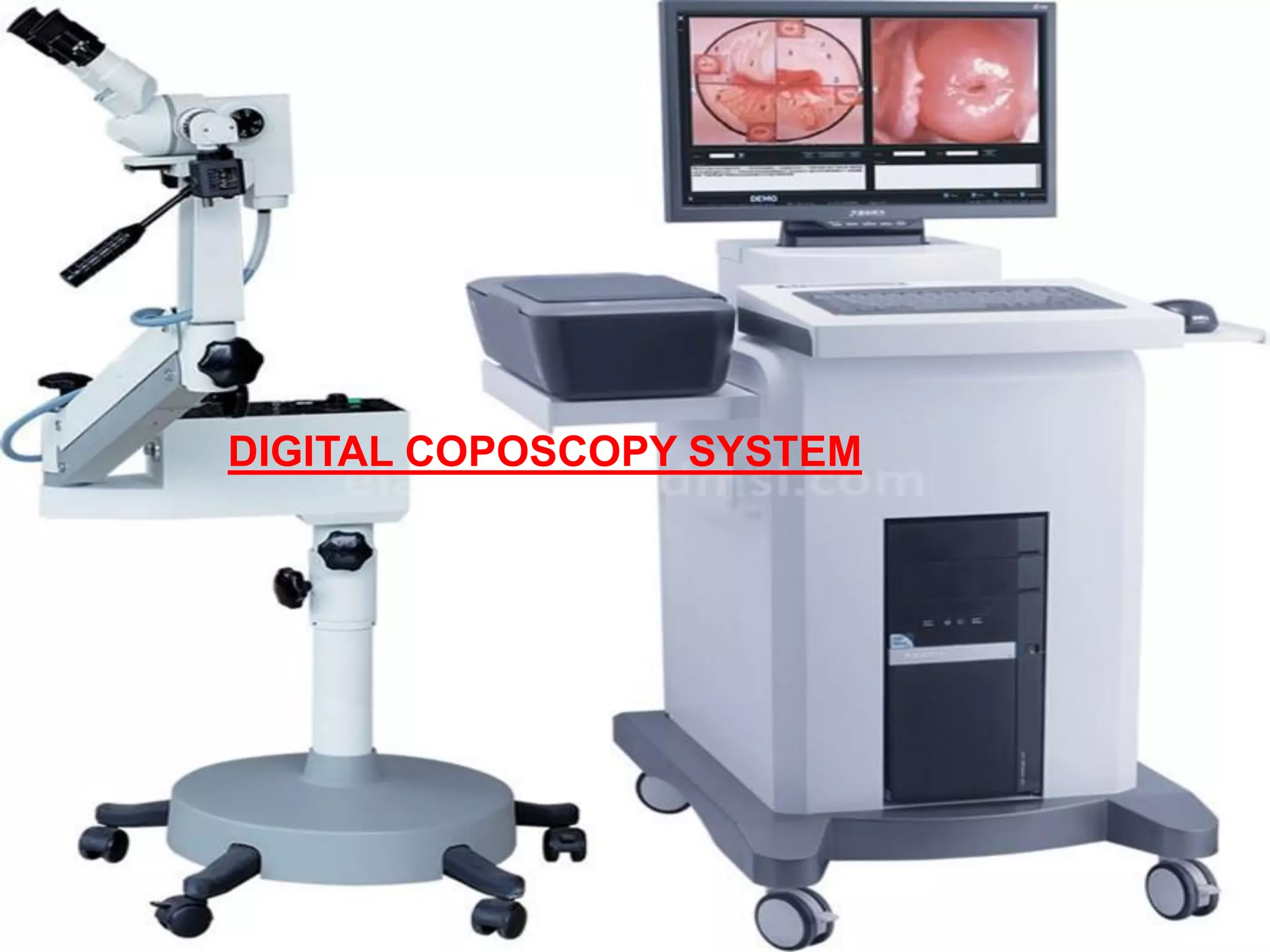 DIGITAL COPOSCOPY SYSTEM
 